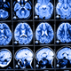 Illustration for article titled Digital Dementia: Your Smart Phone Is Giving You Brain Damage